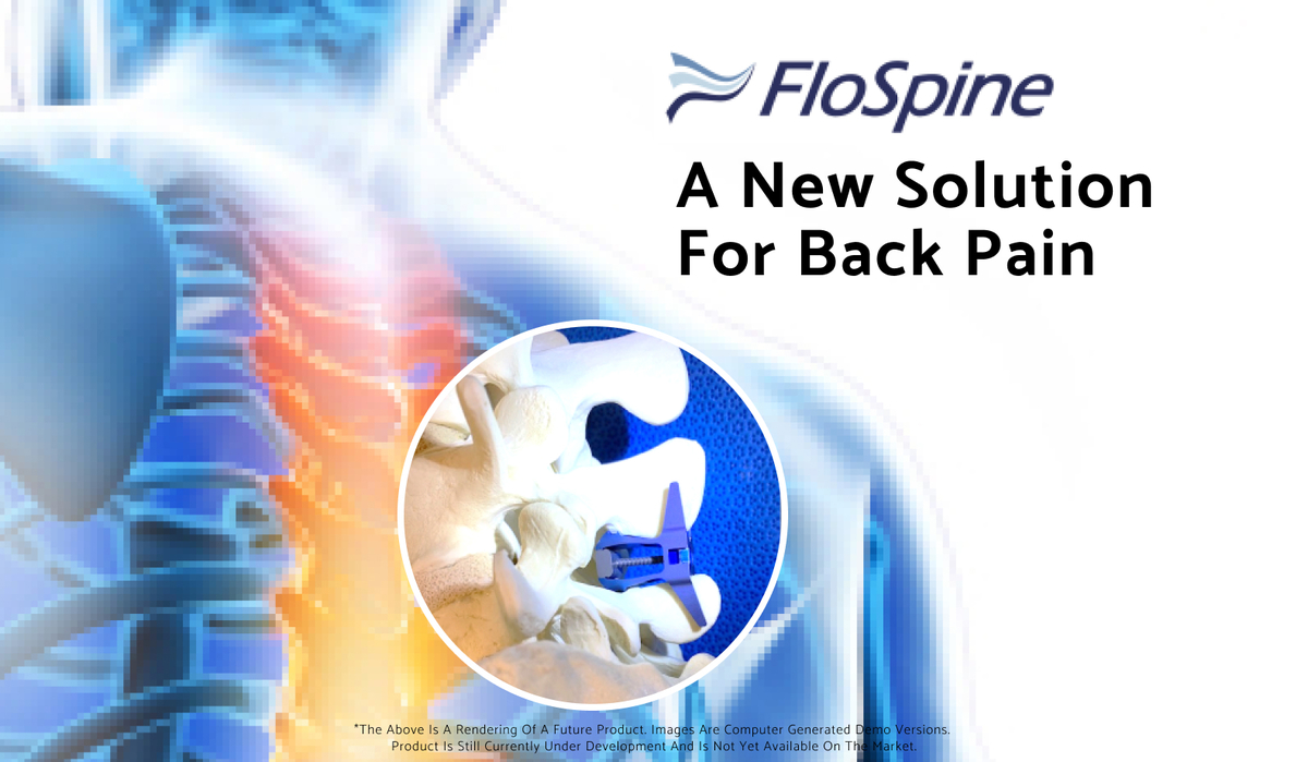 FloSpine offering image